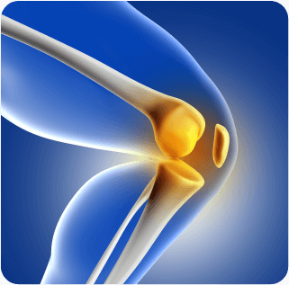 Knee Replacement Surgery